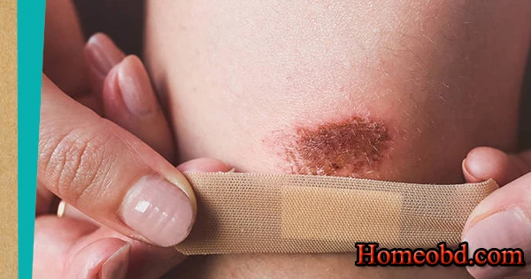 আকস্মিক দুর্ঘটনার চিকিৎসা