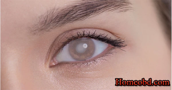 চোখের ছানি