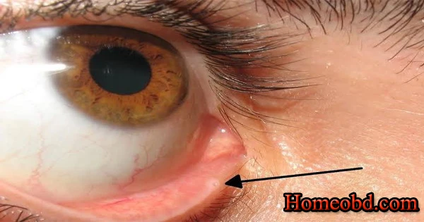 চোখের নালী