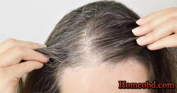 চুল ওঠা ও পাকা