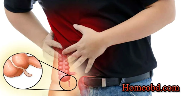 এপেন্ডিসাইটিস