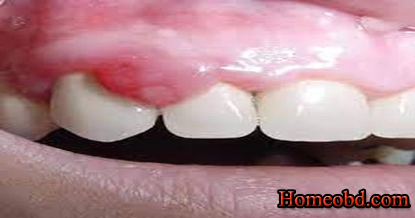 গাম বয়েল