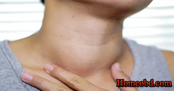 গণোরিয়া