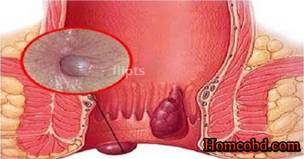গোঁজ পাতার অনুভূতি