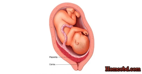 গর্ভফুল না পড়লে