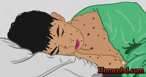 জল বসন্ত