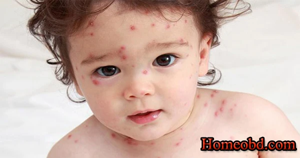 জলবসন্ত