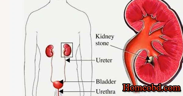 মূত্রে তলানী