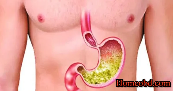 অম্লরোগ(এসিডিটি)