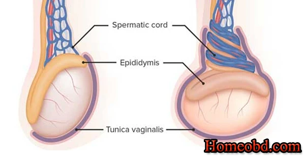 অন্ডকোষের স্নায়ুশূল