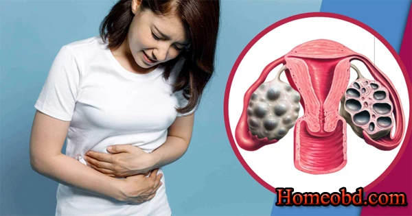 ওভারিতে ব্যথা