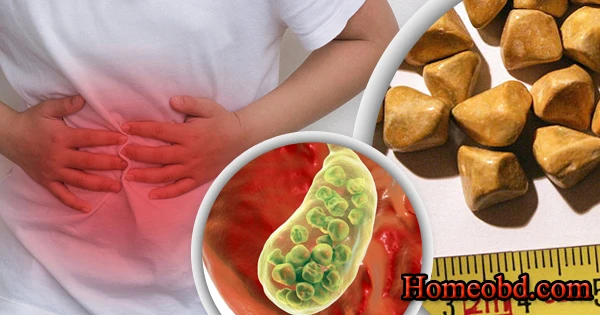 পিত্ত পাথুরি