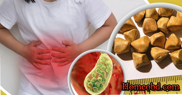 পিত্তপাথুরী