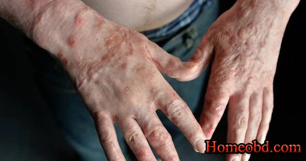 পোড়া নারাঙ্গি