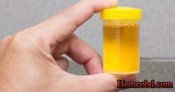 প্রস্রাব ফেনাযুক্ত