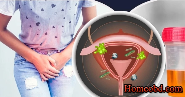 প্রস্রাবে জ্বালা পোড়া