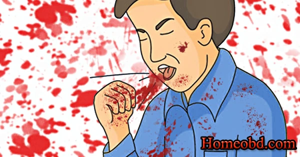 রক্ত কাশি