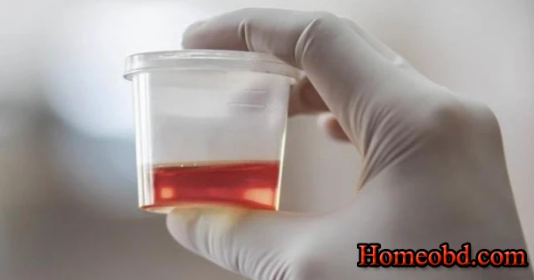 রক্ত প্রস্রাব