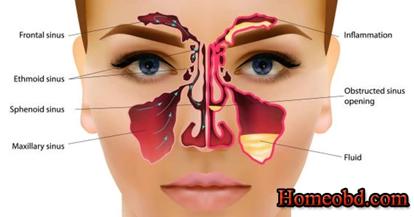 সাইনাস