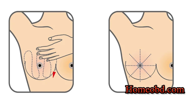 স্তনের বিভিন্ন সমস্যা