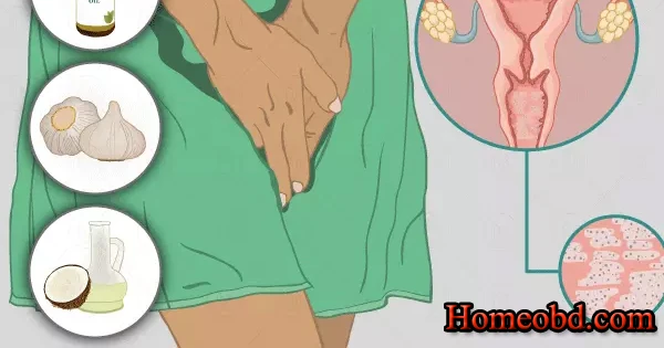 যোনিপথে বাতাস নির্গমন