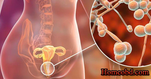 যোনিতে চুলকানি